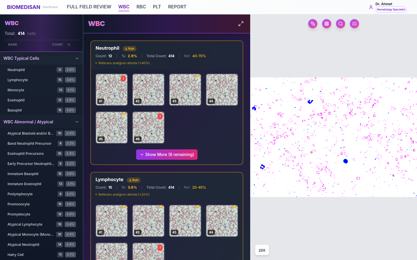 HemAI WBC analysis interface